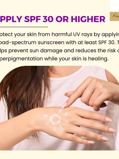 After a chemical peel, your skin is more sensitive to the sun. It is crucial to apply a broad-spectrum sunscreen with at least SPF 30 every day. This protects your healing skin from harmful UV rays and reduces the risk of post-treatment hyperpigmentation.