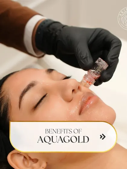 A client receiving the Aquagold Fine Touch treatment. This micro-infusion therapy is ideal for achieving that perfect bridal glow, delivering nutrients directly into the skin for unparalleled radiance.