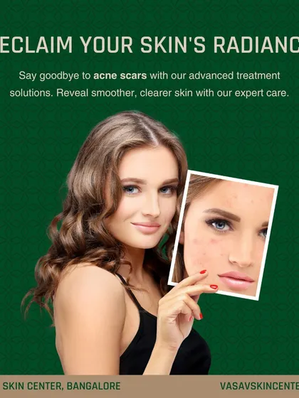 Reclaiming your skin's radiance is entirely possible with advanced treatment solutions. I help patients say goodbye to acne scars by creating a customized plan to reveal smoother, clearer skin through expert, clinical care.