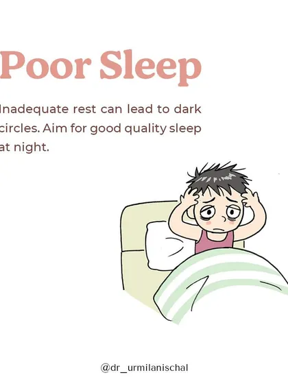 Poor sleep is a primary cause of dark circles. Inadequate rest disrupts your skin's natural repair cycle, leading to poor microcirculation and making blood vessels under the eyes more visible.