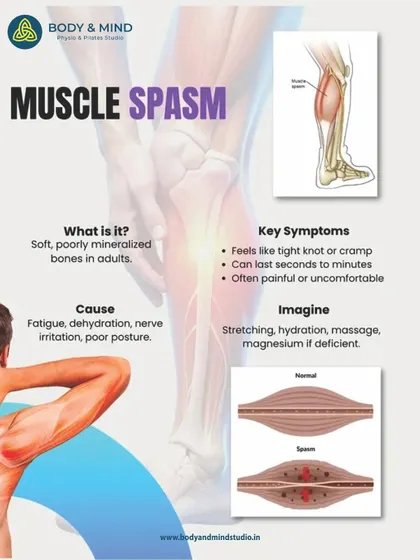 A muscle spasm is a sudden, involuntary tightening of a muscle, often feeling like a tight knot.