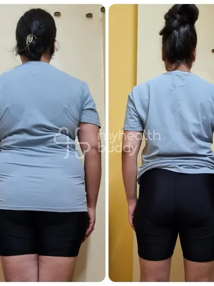 The back view of Shipra's 14kg weight loss. The change in her posture and overall fitness is clear, a result of her commitment to the plan.