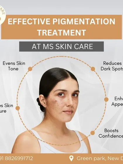 This graphic outlines the benefits of my pigmentation treatments. My goal is to even out skin tone, reduce dark spots, and improve overall texture, which in turn enhances appearance and boosts confidence.