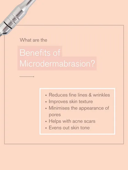 This graphic details the benefits of microdermabrasion. It reduces fine lines, improves skin texture, minimizes the appearance of pores, helps with acne scars, and evens out skin tone.