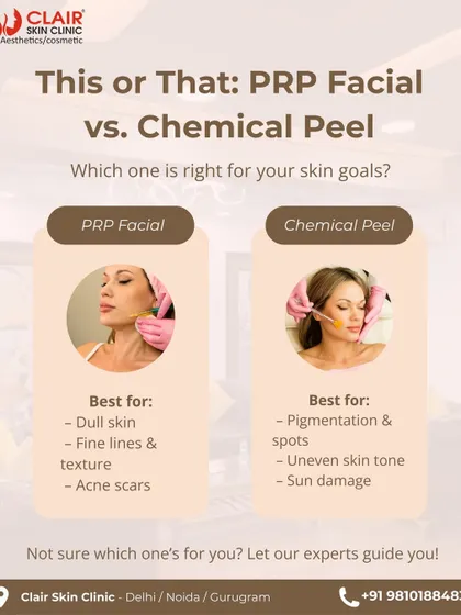 PRP Facial vs. Chemical Peel: which is right for you? This graphic compares the two. PRP is best for dull skin, fine lines, and healing acne scars, while a chemical peel is ideal for pigmentation, sun damage, and uneven tone.