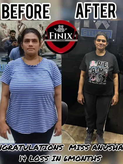 Anusha achieved a 14 kg weight loss in six months with us. Her transformation is not just about the numbers but about the discipline and strength she built along the way, proving that a healthy lifestyle is within reach.