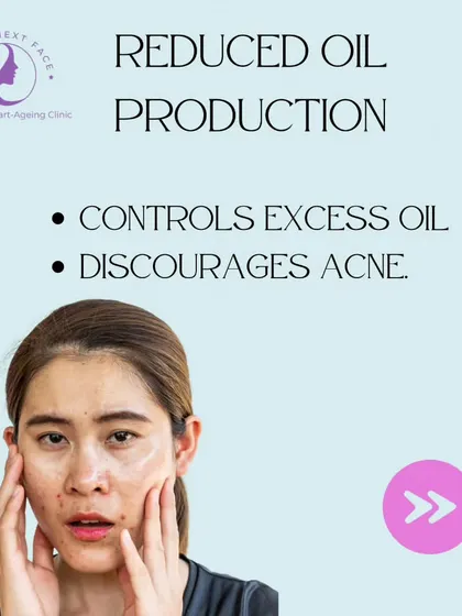Benefit 3 of Peels for Acne: Reduced Oil Production. Certain peels can help control excess oil, which discourages acne formation.