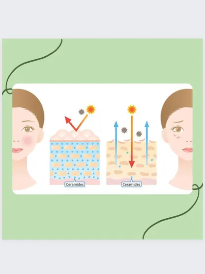 This diagram illustrates how a healthy skin barrier with sufficient ceramides protects the skin, versus a compromised barrier that allows moisture to escape and irritants to enter.