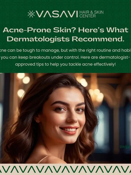 For those with acne-prone skin, I have specific recommendations. Following a routine with the right habits and products can help you keep breakouts under control.