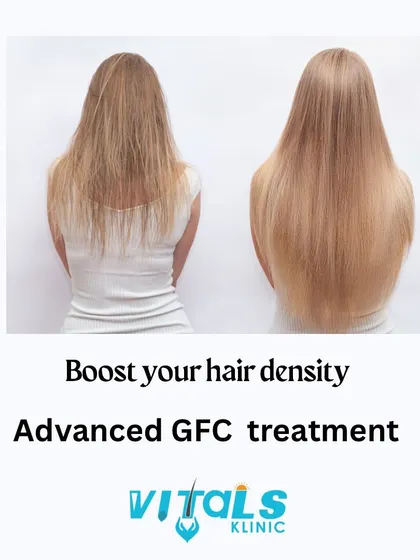 This image illustrates the goal of our hair density treatments like advanced GFC therapy. We focus on increasing the number of healthy hair strands to create a fuller, more voluminous appearance and combat the effects of hair thinning.