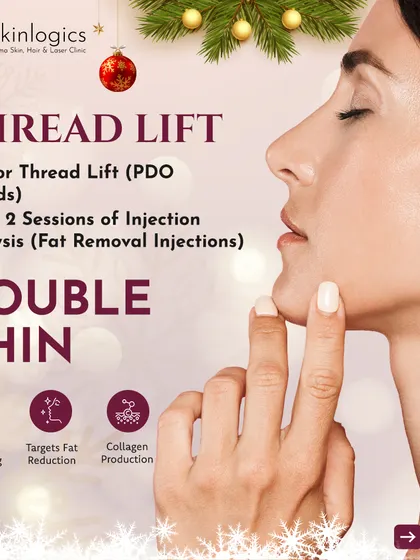 Target a double chin with this New Year offer. When you book a PDO Thread Lift for skin tightening, you get two complimentary sessions of Injection Lipolysis to reduce fat in the area.