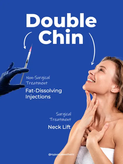 For a double chin, we have both non-surgical and surgical options. Fat-dissolving injections are great for small bulges, while a surgical neck lift provides more significant sculpting and definition.