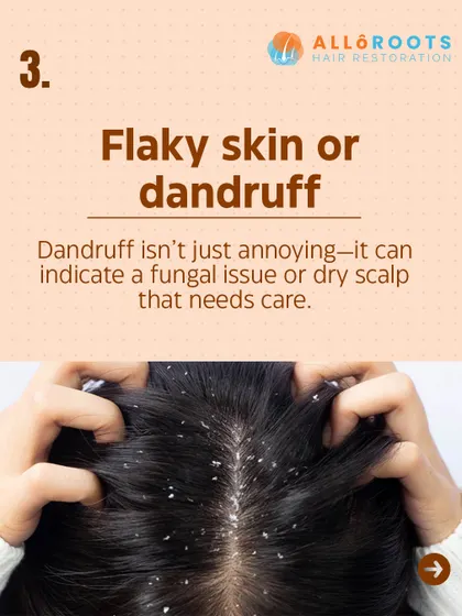 Flaky skin or dandruff is more than just an annoyance. It can indicate a fungal issue or an excessively dry scalp that requires specific care to rebalance the scalp environment and prevent inflammation.
