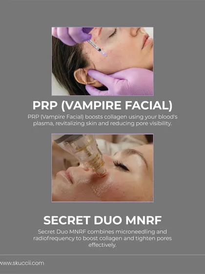 For pore visibility, we harness the power of collagen stimulation. This image explains how PRP (Vampire Facial) uses your body's own plasma to revitalize skin, while Secret Duo MNRF combines microneedling and radiofrequency to tighten pores effectively.