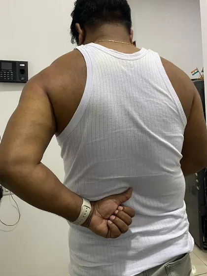 In the early stages of treatment, Mr. Hukum's internal rotation was severely restricted, a classic sign of frozen shoulder. This was our starting point.
