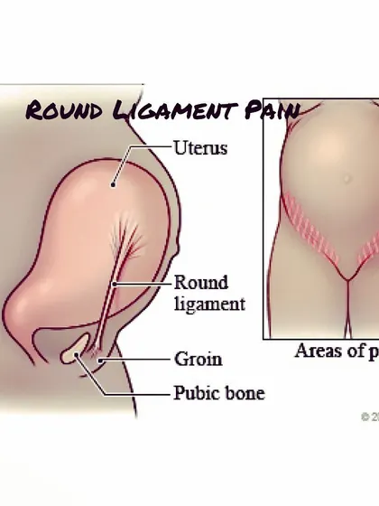 Experiencing sharp, jabbing pains when you move suddenly? That's likely round ligament pain. These ligaments act like support cables for your uterus, and they stretch significantly as your belly grows.