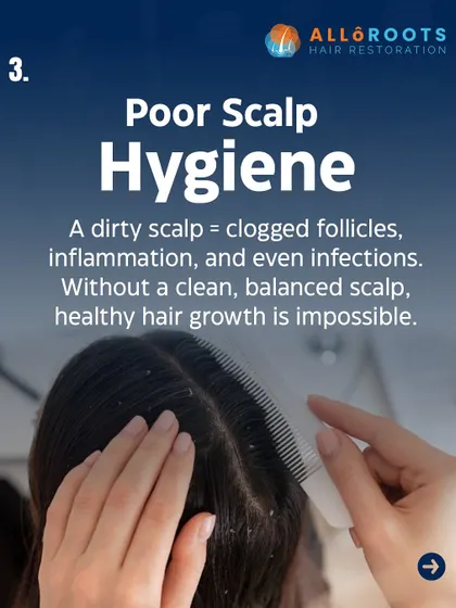 Poor scalp hygiene is a direct cause of hair problems. A dirty scalp leads to clogged follicles, inflammation, and infections, creating an environment where healthy hair cannot grow. A clean, balanced scalp is non-negotiable.