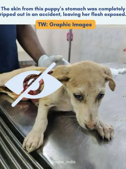 We often use a visual block for graphic images to prepare our audience. The injury was severe, leaving her flesh exposed and at high risk of infection.