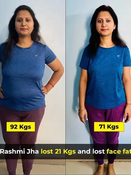 This front view clearly shows the 21kg weight loss, from 92kg to 71kg. It's a testament to her consistency with the simple diet and home workouts I provided.