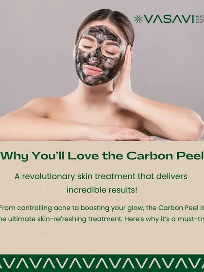 The Carbon Peel is a revolutionary skin treatment that delivers incredible results. From controlling acne to boosting your glow, it is an ultimate skin-refreshing procedure.