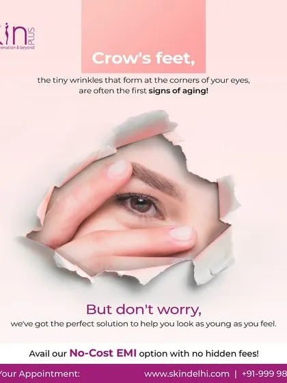 Crow's feet are often the first sign of aging, but we have the perfect solution. Targeted treatments like PRP and fillers can help you look as young as you feel by smoothing these fine lines around the eyes.