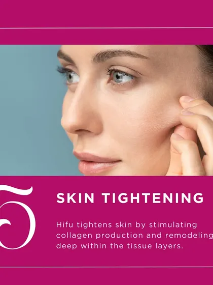 Skin tightening is one of the primary outcomes of a HIFU treatment. The technology works by stimulating collagen and remodeling tissue deep within the skin, providing a noticeable firming effect.