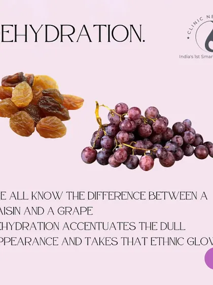 Think of your skin like a grape. Dehydration can turn it into a raisin, accentuating dullness and fine lines. Our IV drips provide deep, systemic hydration that water alone can't, helping you maintain that plump, glowing, and healthy skin.