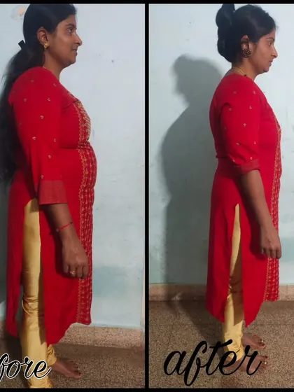 This is the transformation of Chaithra from Turuvekere, who lost 8.5 kg and 17 cm from her belly in just 3 months. Her journey shows that with the right guidance for PCOD, significant changes are possible even with simple home workouts and a natural diet.