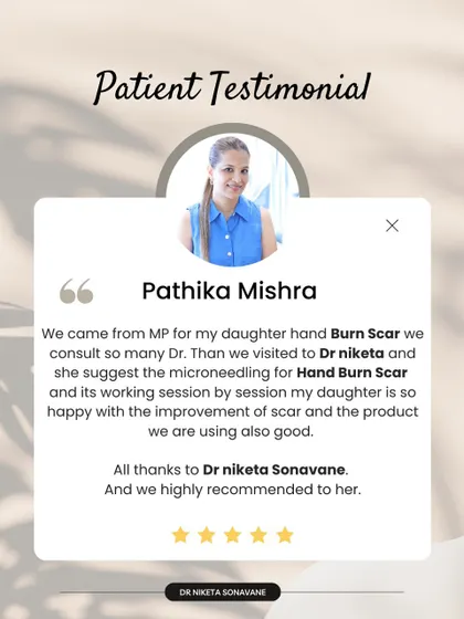This family came all the way from MP for their daughter's burn scar. Seeing her happiness with the improvement after microneedling is incredibly fulfilling.