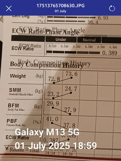 The same patient's progress tracked over time. The upward trend in skeletal muscle mass and the downward trend in body fat mass demonstrate the success of our medically guided Tirzepatide and Wonder Prestige program.
