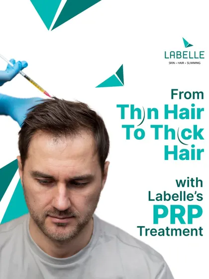 Go from thin to thick hair with our advanced PRP treatment. This image illustrates how the procedure targets areas of thinning to restore fullness and health, making it an excellent choice for reversing the signs of hair loss.