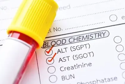 This image of a blood chemistry report highlights the importance of lab analysis in my work. Elevated SGPT levels can indicate liver inflammation, which is linked to chronic inflammation and an increased risk of cardiac issues.