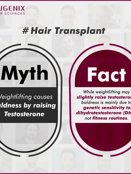 A series of graphics debunking common myths about fitness and hair loss, such as whether exercise, sweating, or high-protein diets cause baldness.