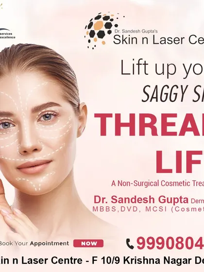 A thread lift is a non-surgical cosmetic treatment to lift up saggy skin. This graphic illustrates how threads are used to provide a subtle, natural-looking lift to the face and neck.