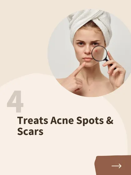 Benefit 4 of PlasmoDerm: PlasmoDerm can be used to effectively treat acne spots and scars by promoting tissue regeneration.