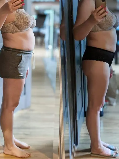 This side profile view shows the significant changes in body composition my 50 year old client achieved in just one month. We focused on a sustainable fat reduction plan that she could manage alongside her daily life.