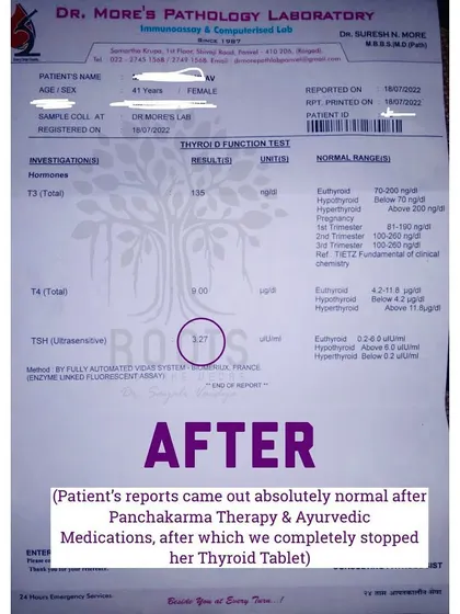 After: A later report shows a normal TSH of 3.27. After Panchakarma therapy and Ayurvedic medications, we were able to completely stop her thyroid tablet.