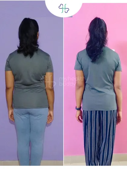 This client learned about Diastasis Recti after her pregnancy and decided to take action. In 12 weeks, she lost 6 kgs and significantly improved her core strength by focusing on portion control and targeted exercises.