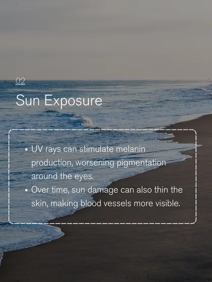 Sun exposure is a major cause of under-eye pigmentation. UV rays stimulate melanin production and can thin the skin over time, making blood vessels more visible.