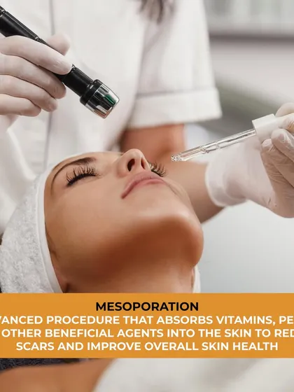 Mesoporation is an advanced procedure that helps the skin absorb vitamins, peptides, and other beneficial agents. It is used to reduce scars and improve overall skin health.