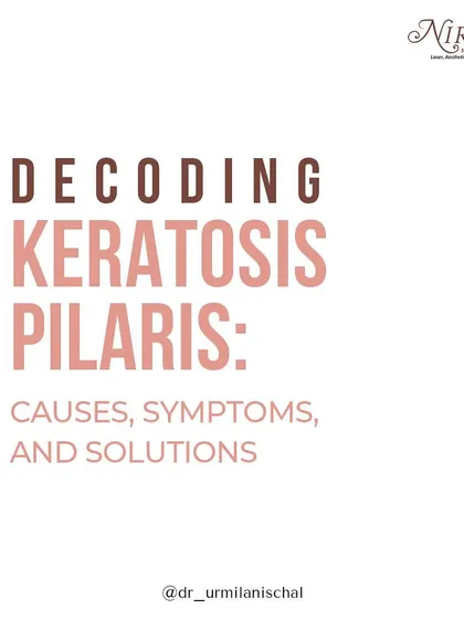 This post decodes Keratosis Pilaris, a common skin condition causing dry, rough patches and tiny bumps. Here, I explain the causes, symptoms, and effective solutions to help you achieve smoother, healthier skin.