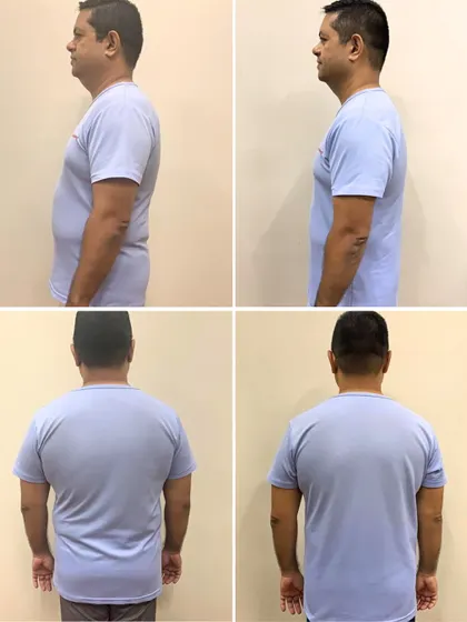 The side and back views of Venura's transformation demonstrate a clear improvement in posture and a leaner physique, proving that consistency plus the right guidance delivers results.