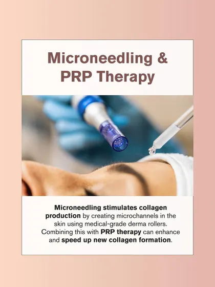 Microneedling with PRP is another powerful combination for treating acne scars. It uses medical-grade derma rollers to stimulate collagen, with PRP speeding up the healing process.