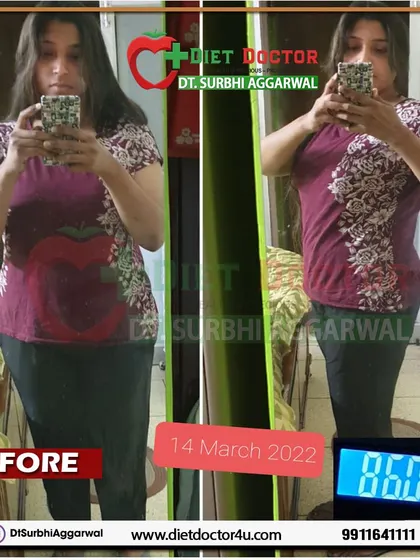 This before photo shows a working professional who had tried intermittent fasting and other fad diets without lasting success. She started my program to finally get fit with a balanced approach.