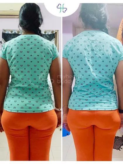 Back view of her progress. Even a small weight change can result in significant visual improvement and better health.