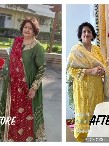 Here is another angle of this amazing 70 year old client's transformation. She looks radiant and healthy after losing 9 kgs in three months, embracing a new, fitter lifestyle.