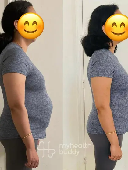This client not only lost fat but also healed her Diastasis Recti. My programs are customized to address specific needs like postpartum recovery, helping you rebuild a strong core.