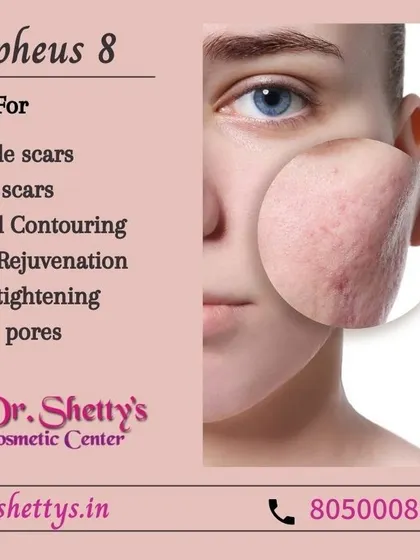 Morpheus 8 is an advanced treatment for skin rejuvenation. It is highly effective for improving a variety of concerns, including pimple scars, acne scars, open pores, and overall skin tightening and facial contouring.
