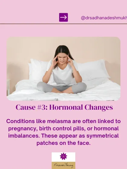 Hormonal changes are a common trigger for pigmentation conditions like melasma, which often appears as symmetrical patches on the face. These changes can be linked to pregnancy or birth control pills. A professional diagnosis is key to managing this complex condition.