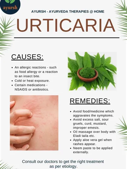 This infographic explains Urticaria (hives) from an Ayurvedic perspective, outlining its causes and remedies. We suggest avoiding aggravating foods and using external applications like Eladi taila, aloe vera, and neem paste to soothe the skin.